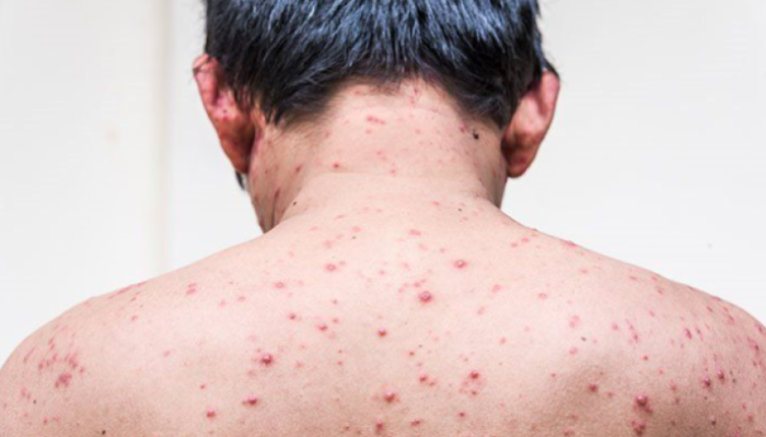 Representational photo: Collected