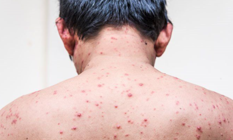 Representational photo: Collected