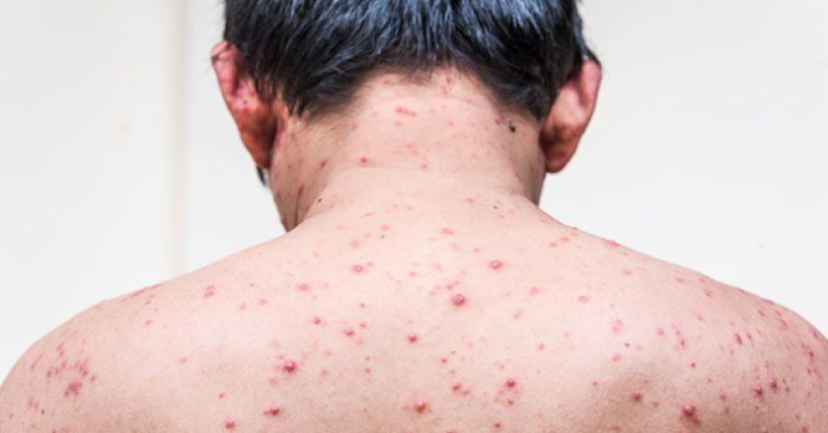 Representational photo: Collected