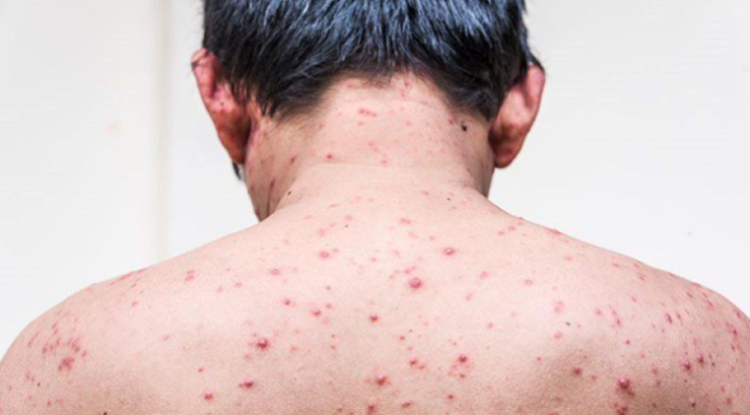 Representational photo: Collected